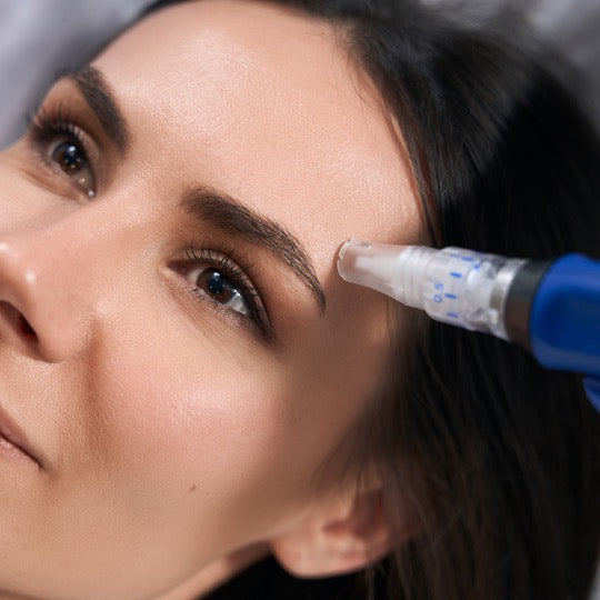 Microneedling: Which Treatment Is Right for You?