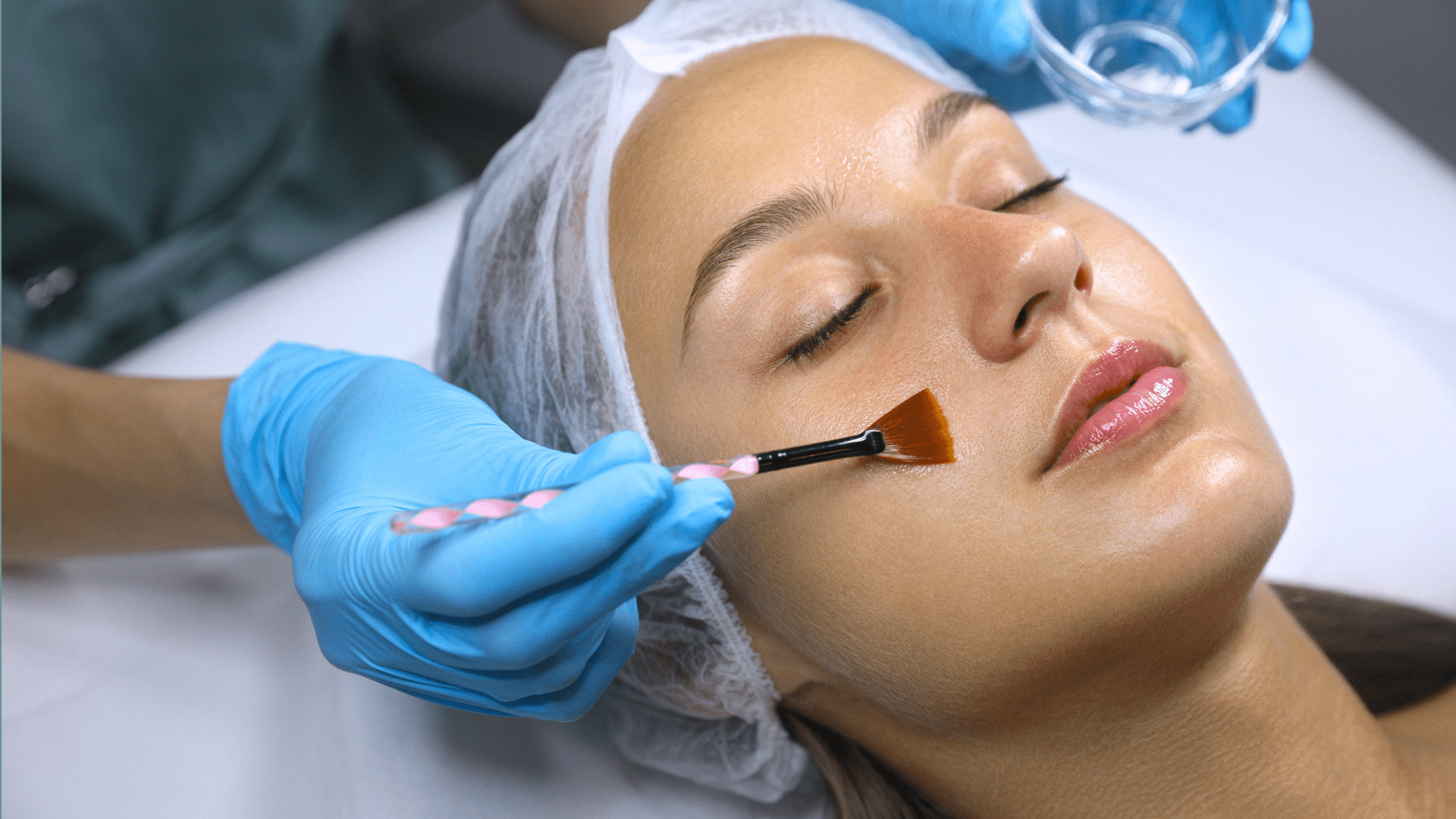 Vi Peel Before and Aftercare: What You Need to Know - BEAUTYFLUFF