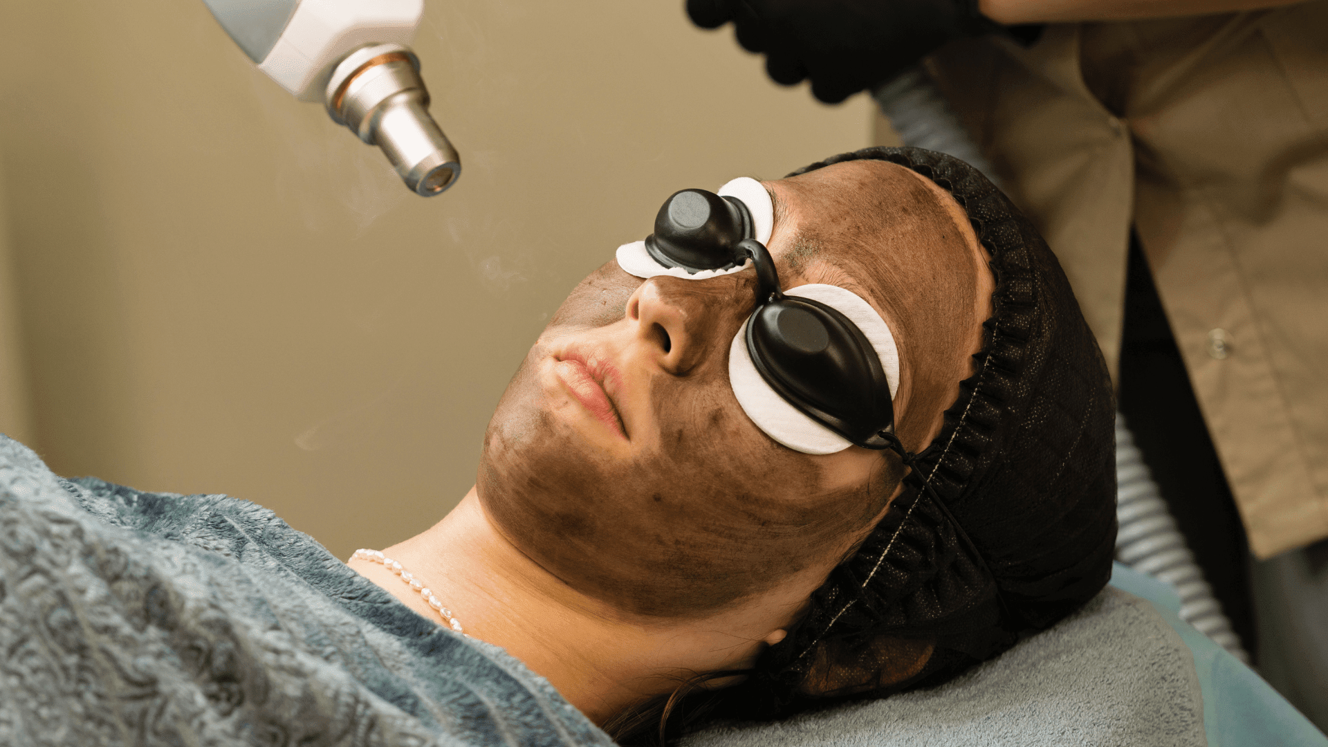 Carbon Laser Peel Before and Aftercare: What You Need to Know - BEAUTYFLUFF