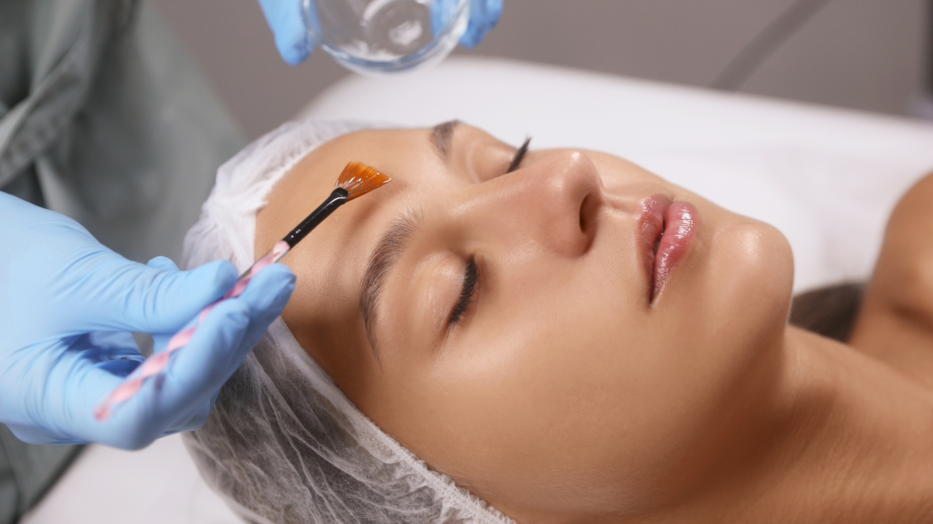 What's the Deal with VI Peels?